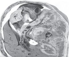 agile_ultrasound.bmp
