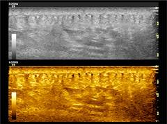 improvements_in_high_resolution_ceus_after_free_tissue_transfer.jpg