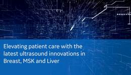 Elevating patient care with the latest ultrasound innovations in Breast, MSK and Liver