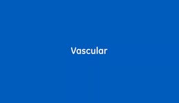 Vascular LOGIQ™ E10 R2_ES