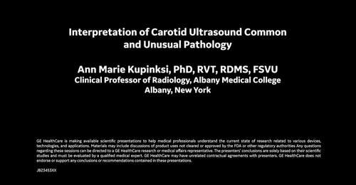 Interpretation of Carotid Ultrasound Common and Unusual Pathology by Dr. Ann Marie Kupinksi