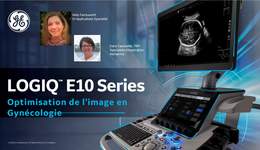 LOGIQ E10 Series Optimisation de l'image en Gynecologie