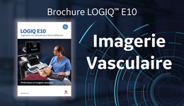 LOGIQ E10 Imagerie vasculaire Brochure FR