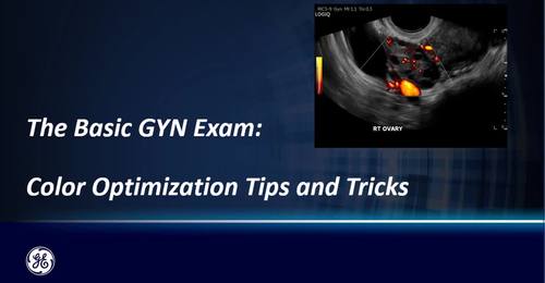 The Basic GYN Exam Color Optimization Tips and Tricks