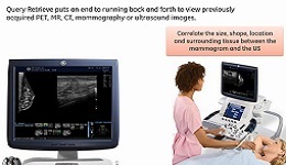 Breast Ultrasound Overview Technology