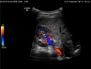 abd-sm33-start-image.jpg