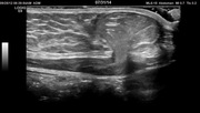 liver05-start-image.jpg