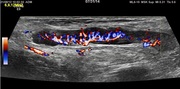 lymphnode-start-image.jpg