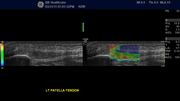 ml6-15-d_5.jpg