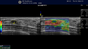ml6-15-d_7.jpg
