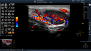 ml6-15-thy-cf-whole-screen.bmp