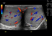 teste-l3-12-cf.jpg