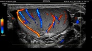 testicular-start-image.jpg