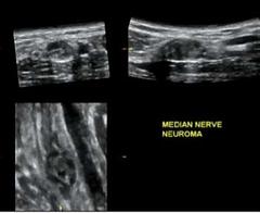 clinical_impact_of_volume_ultrasound_for_musculoskeletal_imaging.jpg
