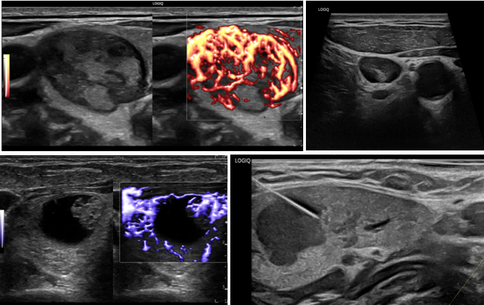 h-n-clinical-images.PNG