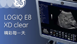 LOGIQ E8 XD Clear Brochure