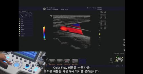 LOGIQ P9 - Pulsed Wave Doppler Controls