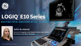 LOGIQ E10 Series Routine Fetal Anatomy at 12 to 14 Weeks 