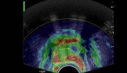 Cases from Experts - Multi-parametric Imaging of the Pro ...