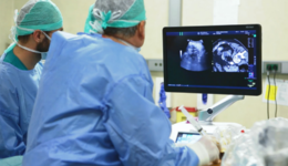 LOGIQ E9 XDclear 2.0 US and V Nav Fusion Imaging for Liver ...
