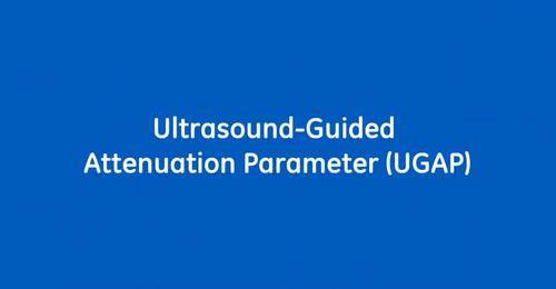 Video Power Demo LOGIQ™ E10 / GE Healthcare Ultrasonidos