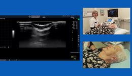 Live ultrasound scanning assessing the salivary glands with Lene Terslev, PhD