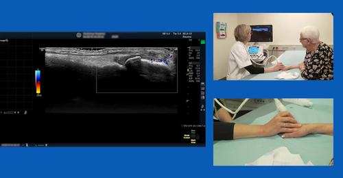 Live ultrasound demo of quantitative scoring of synovitis with Lene Terslev, PhD