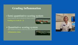 The use of ultrasound for quantitative scoring of synovitis with Lene Terslev, PhD