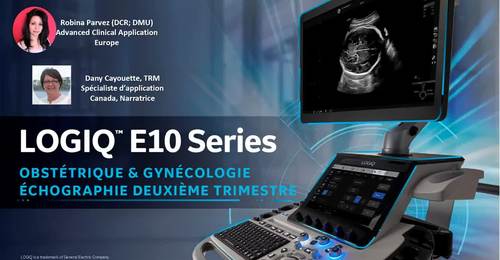 LOGIQ E10 Series Obstetrique & Gynecologie Echographie Deuxieme ...