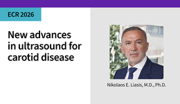 New advances in ultrasound for carotid disease