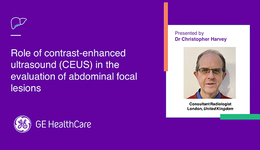 LIVER - Role of contrast-enhanced ultrasound (CEUS) in the evaluation of abdominal focal lesions