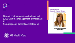 LIVER - Role of contrast-enhanced ultrasound (CEUS) in the management of malignant FLL from diagnosis to treatment follow-up