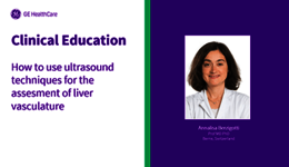 LIVER – How to use ultrasound techniques for the assessment of liver vasculature - Prof Dr Annalisa Berzigotti