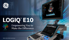 LOGIQ E10 - Comprehensive Guide