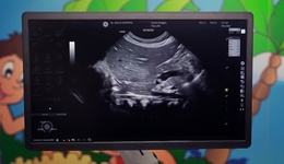 Dr Ajay Dsouza -LOGIQ P10 XDclear Pediatric Radiology