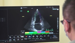 Susumu Nishio PhD - LOGIQ P10 XDclear - Cardiac Strain