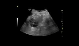 Ultrasound A Clinical Case Study How and Why to Use CEUS ...