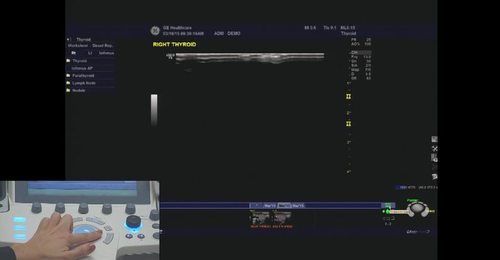 LOGIQ P9/P7- Compare Assistant