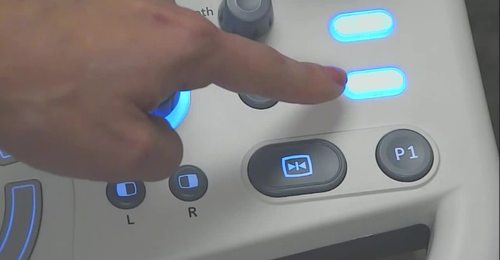 LOGIQ P9/P7- Saving single image and clips