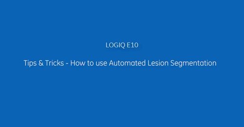 LOGIQ E10 Tips  Tricks How to use  Automated Lesion Segmentation